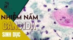 Nấm Cadida ở nam: Tất tật về dấu hiệu nhận biết, cách chữa