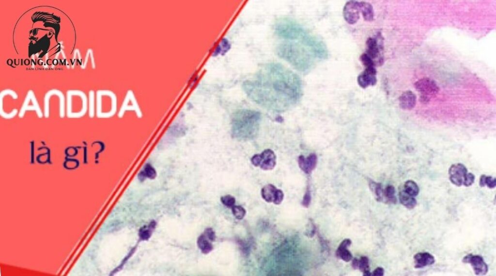 Nấm Candida ở nam là gì? 